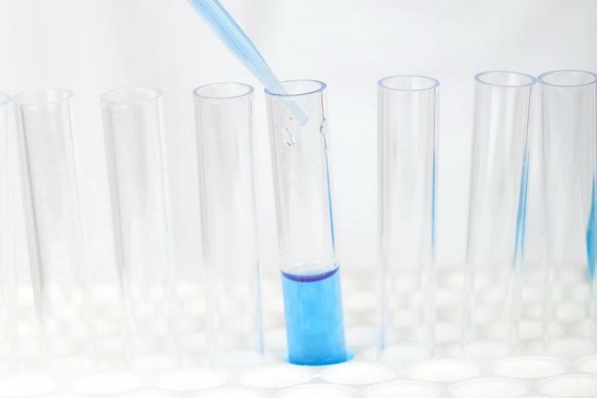 Эксперты «Жить здорово!» рассказали о ненужном анализе