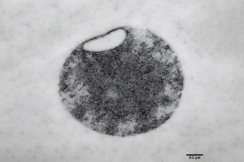 Ученые создали «минимальную клеточную мембрану» всего из двух липидов